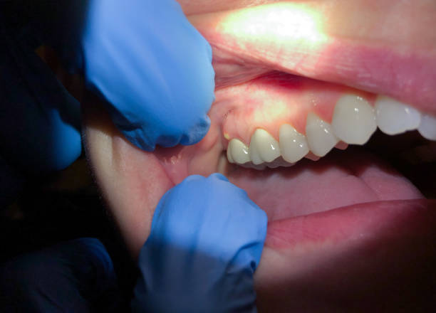 Best Knocked-Out Tooth Emergency  in Moroni, UT